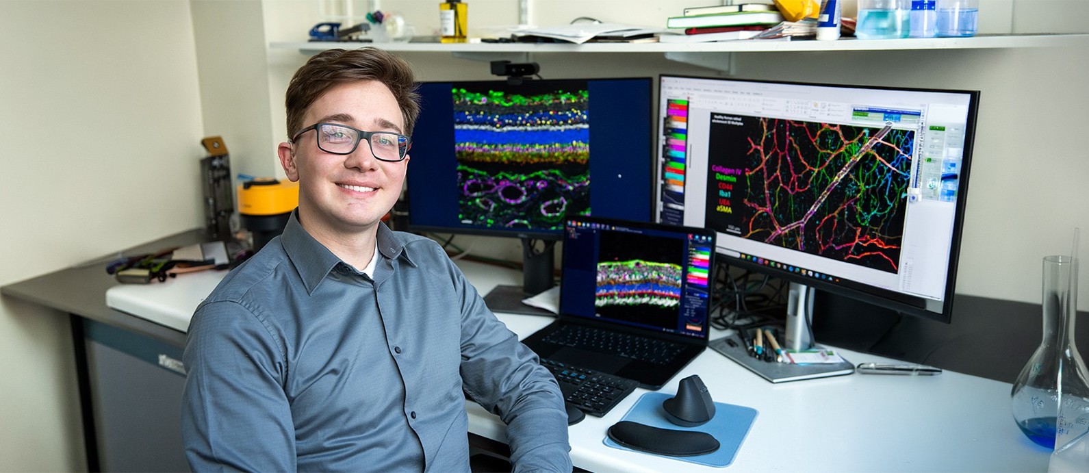A new frontier: creating an ‘atlas’ of the macula primary image