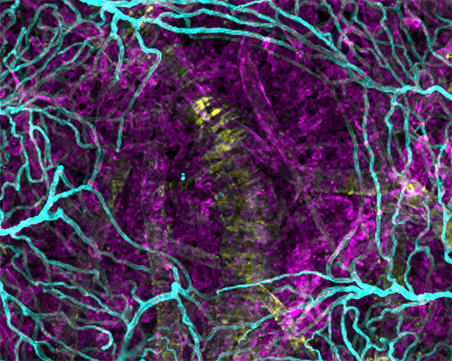 2D scan of macula