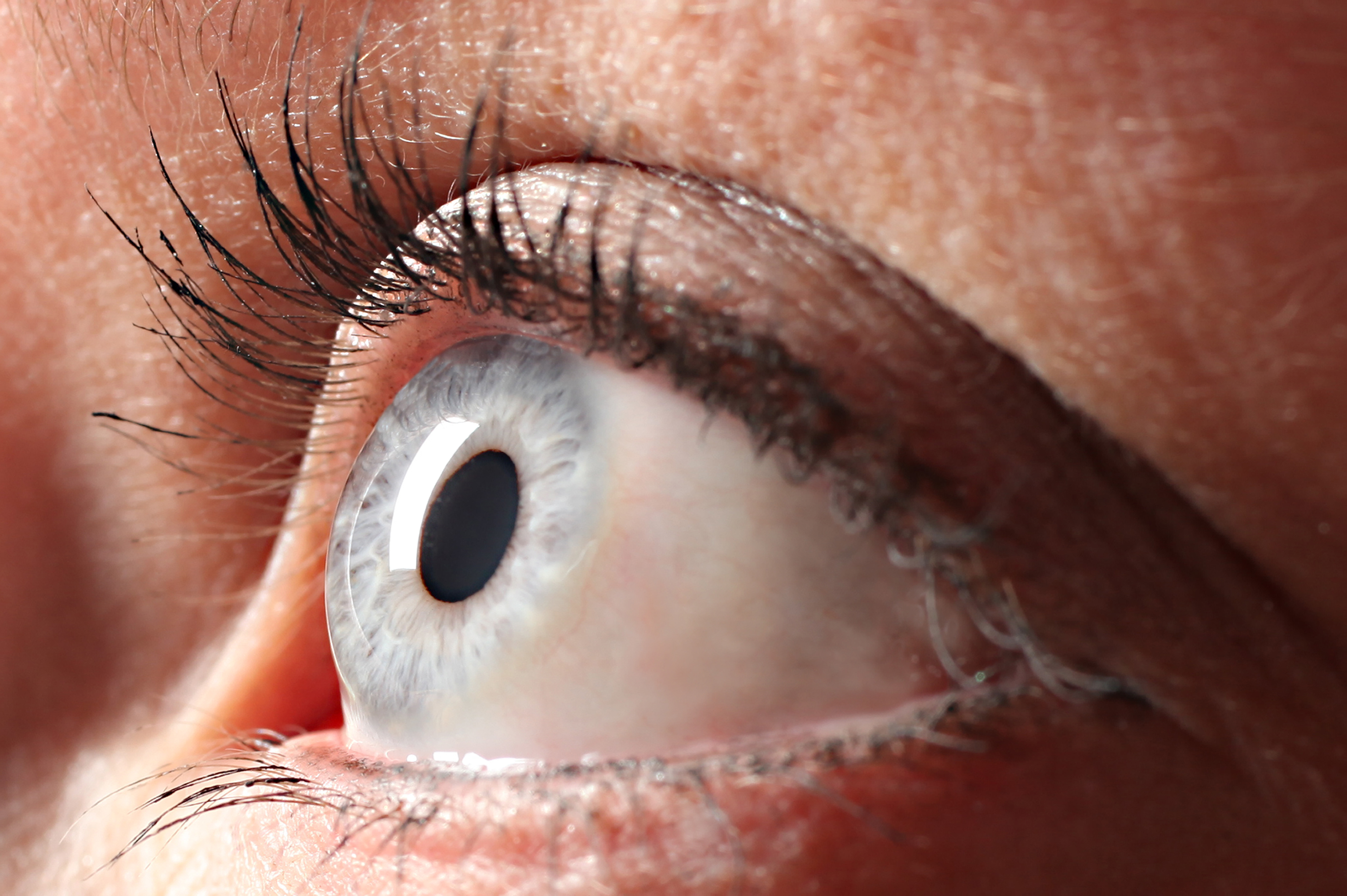 Doyne honeycomb dystrophy primary image