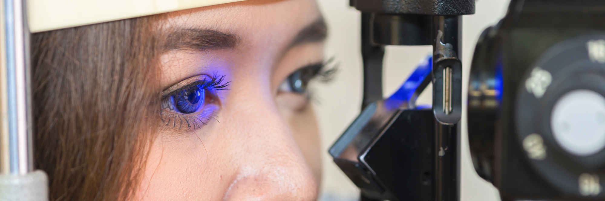 Fluorescein angiography primary image