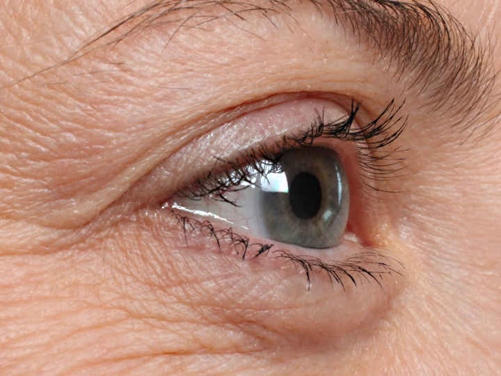 Older Blue Eye Looking Left
