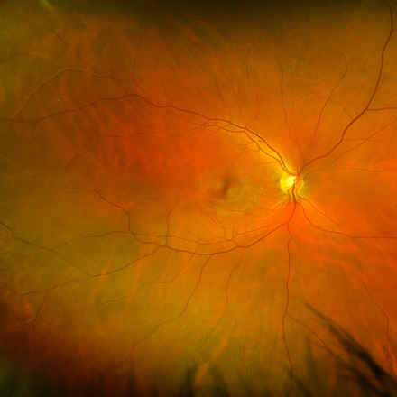 retina_macular_eye_blood_vessels.jpeg