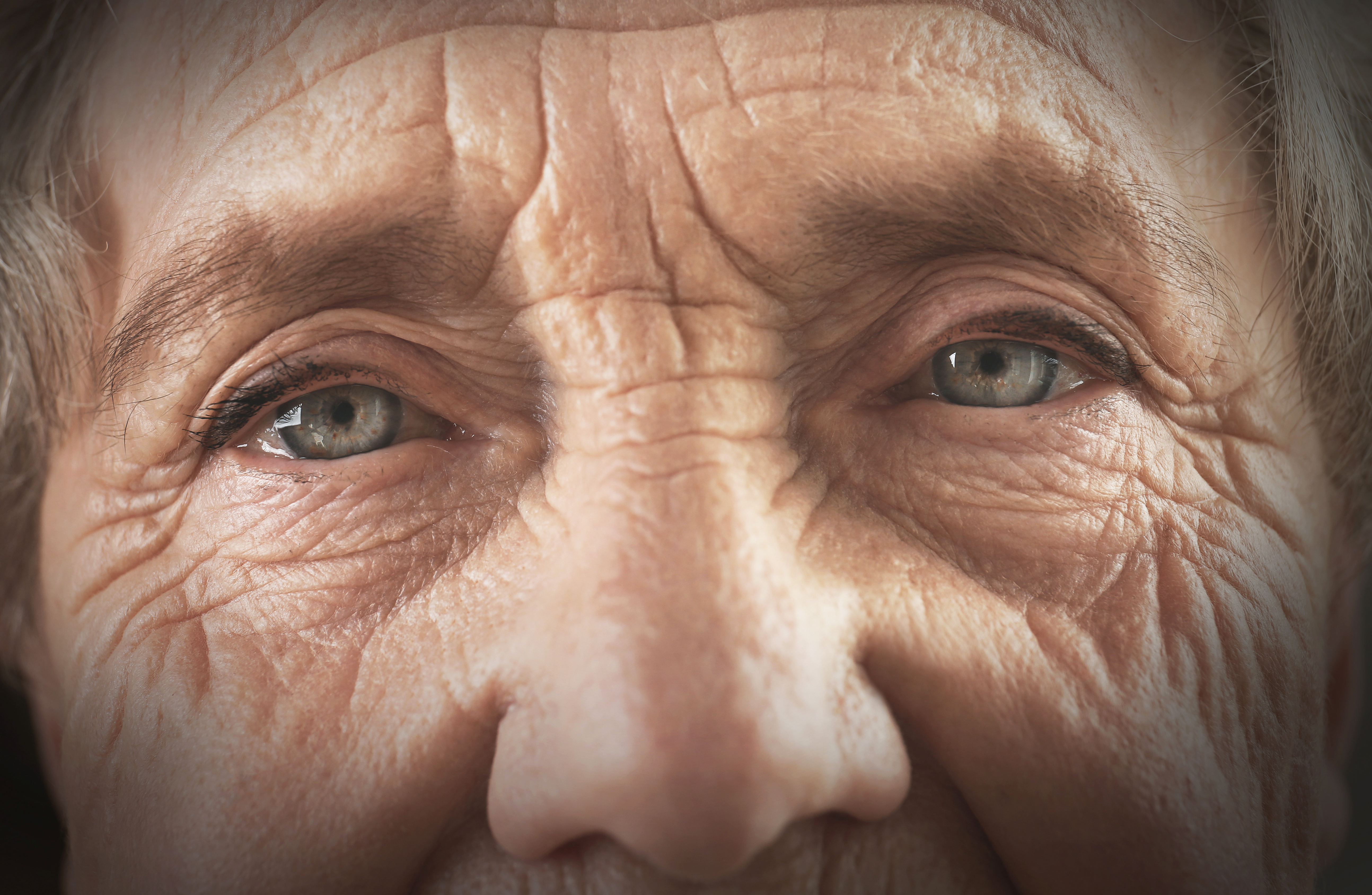 Age-related macular degeneration primary image