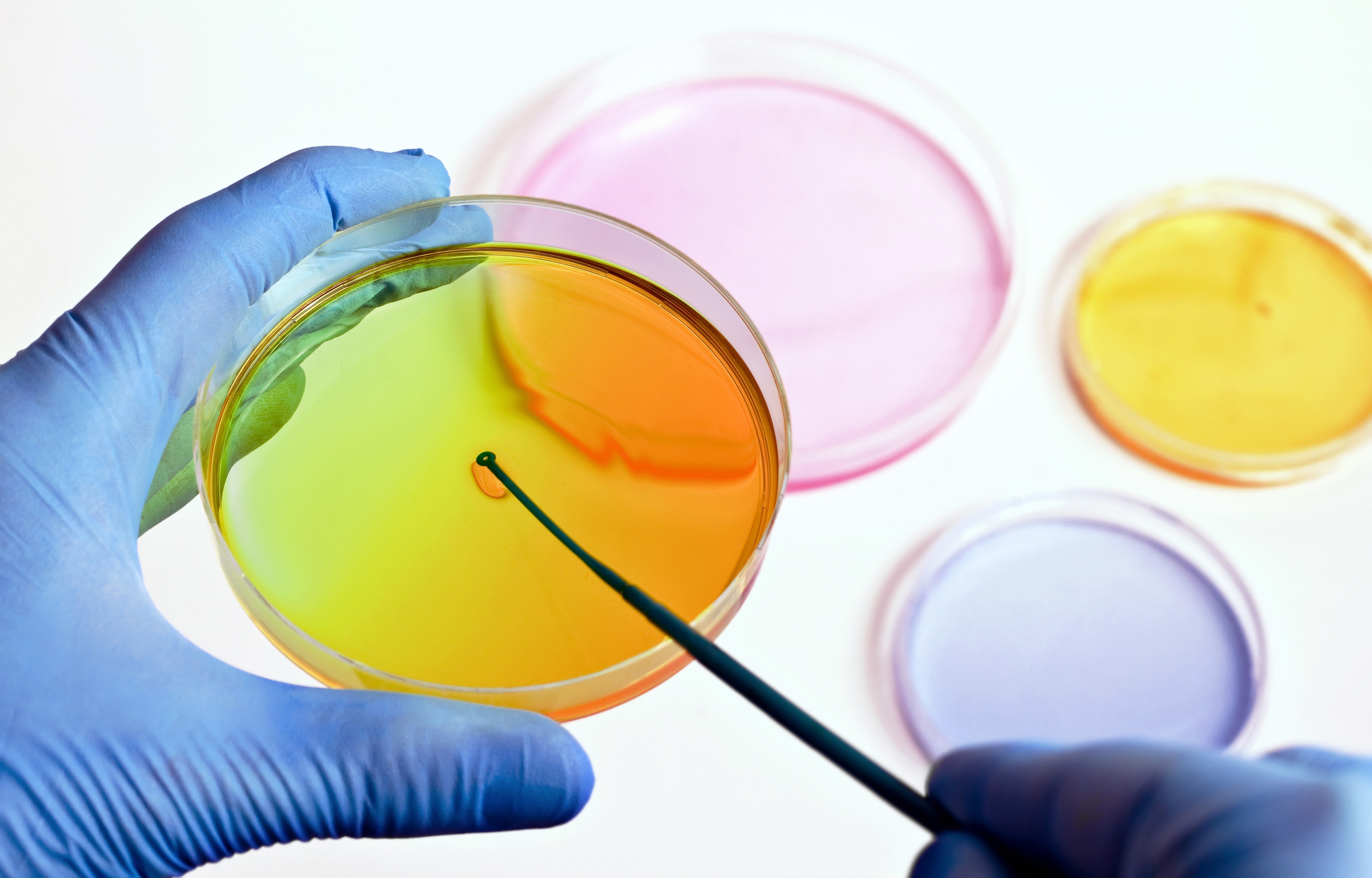 Stem cell therapy primary image
