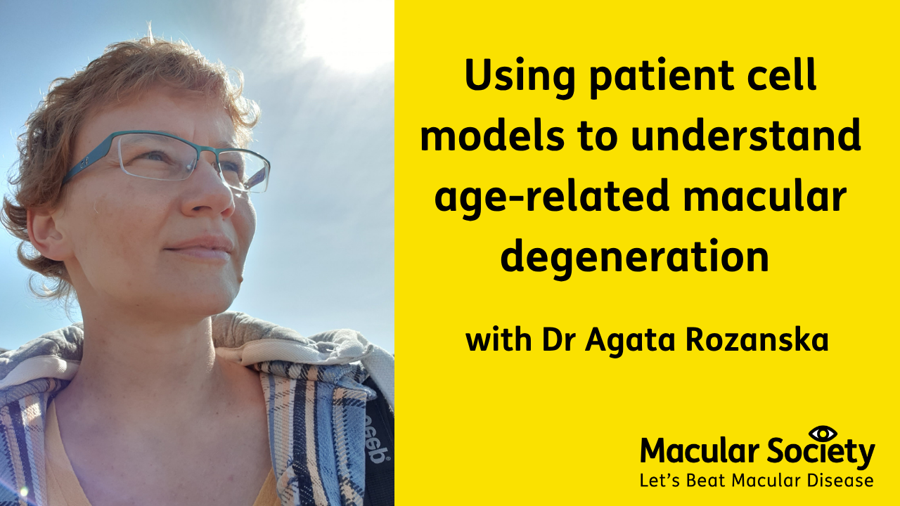 Headshot of Agata Rozanska with text reading Using patient cell models to understand AMD