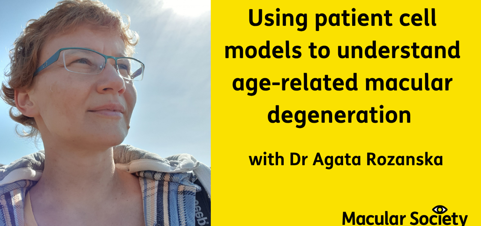Headshot of Agata Rozanska with text reading Using patient cell models to understand AMD